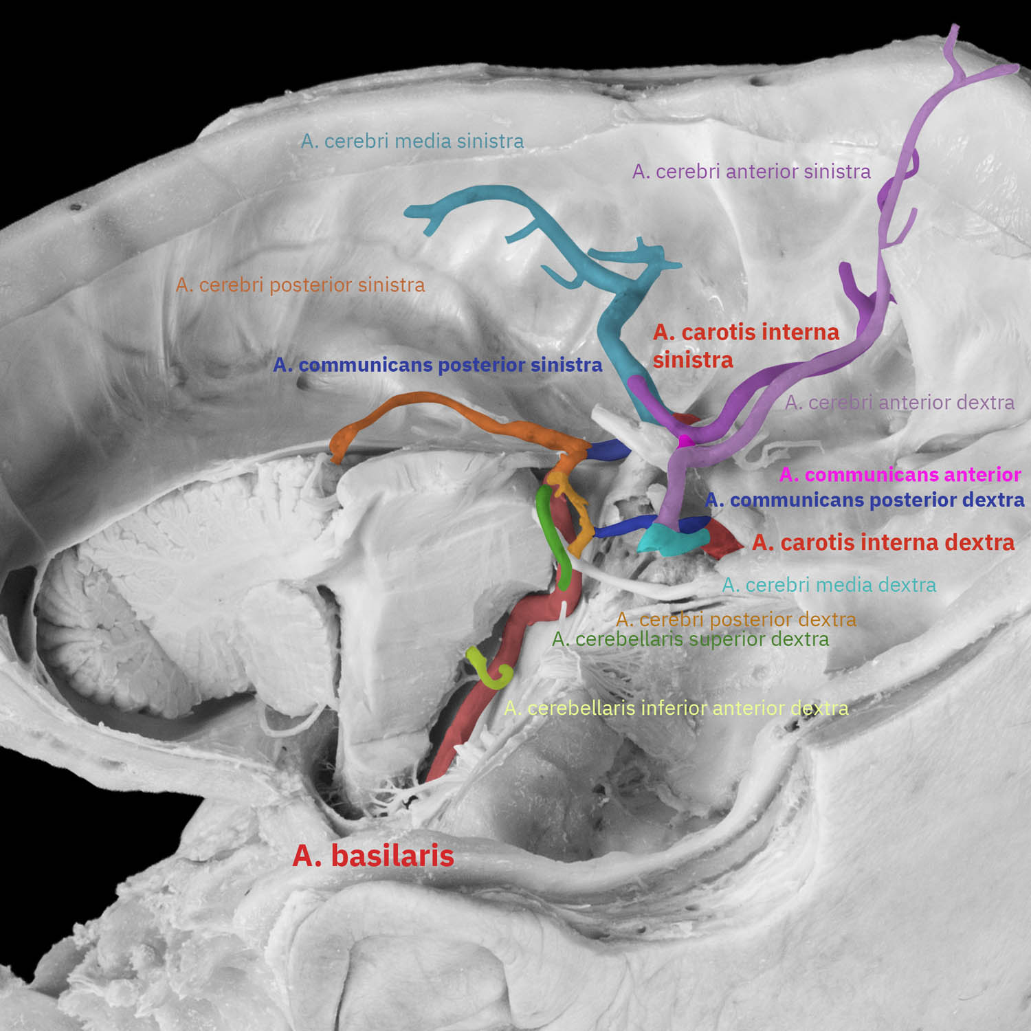 IG Hirnarterien präpApp Early Access