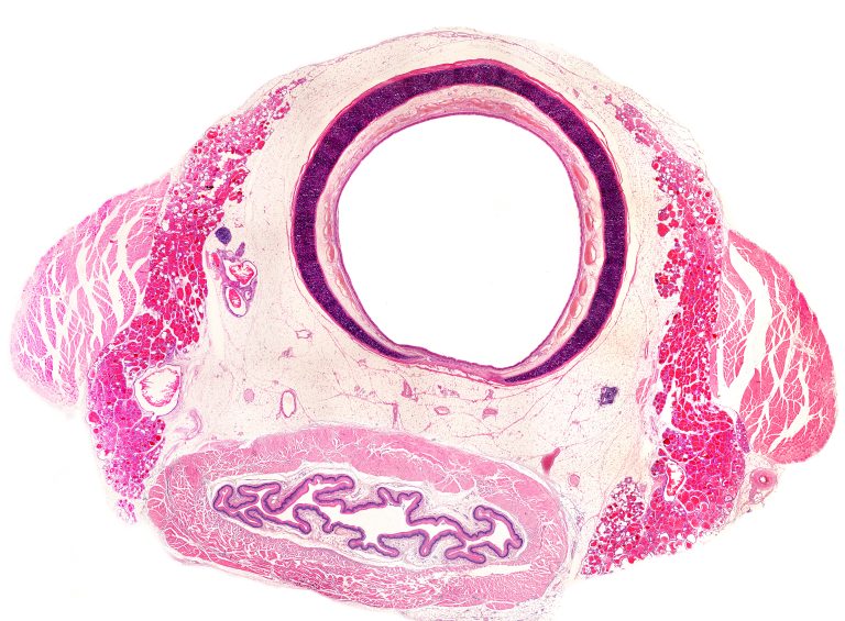 Querschnitt von Trachea und Ösophagus auf Höhe der Schilddrüse.