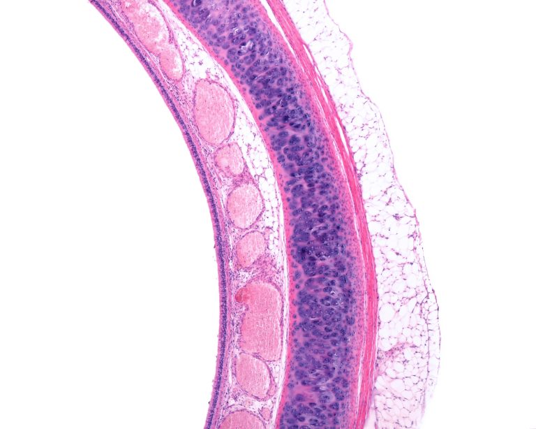 Querschnitt durch die Trachea mit den verschiedenen Wandschichten von innen nach außen: repsiratorisches Epithel mit Lamina propria und Blutgefäßen, hyalinem Cartilago trachealis und Tunica Adventitia