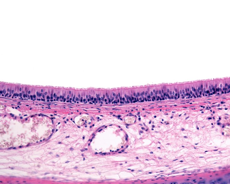 Querschnitt durch die Trachea mit den verschiedenen Wandschichten von innen nach außen: repsiratorisches Epithel mit Lamina propria und Blutgefäßen, hyalinem Cartilago trachealis und Tunica Adventitia