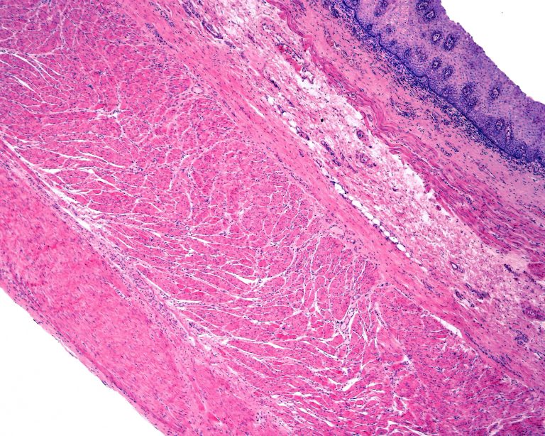 Layers of the wall of a human esophagus: mucosa (with epithelium, lamina propria, and muscularis mucosae), submucosa, muscular (inner and outer layers) and a very thin adventitia.
