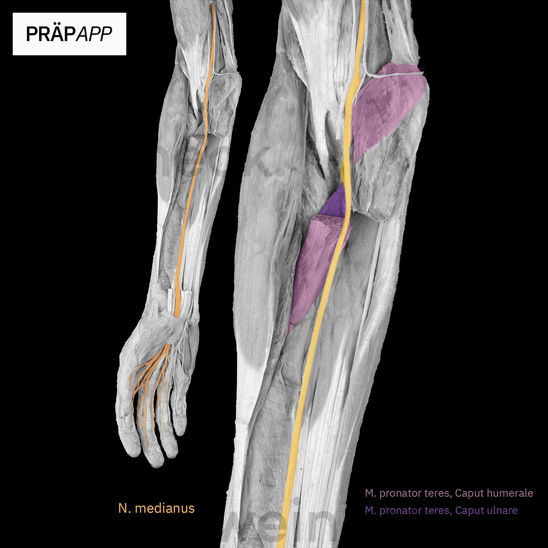 Nerven Der Oberen Extremit T N Medianus Pr Papp Early Access